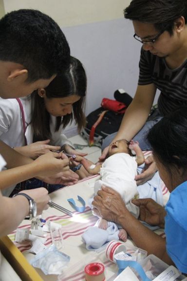 One-month old Vinz Emmanuel Balo gets financial assistance from the Cebu provincial government to facilitate immediate surgery. (CONTRIBUTED)