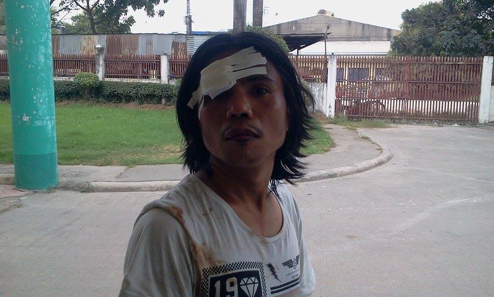 Jerry Canete, 21, of Paknaan, Mandaue City, arrested for armed robbery but was mauled by bystanders prior to his arrest.