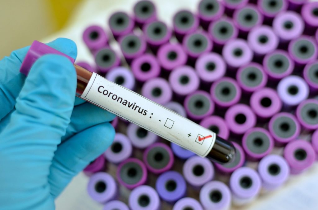 CORONAVIRUS DISEASE 2019 (COVID-19) | INQUIRER.NET FILE PHOTO