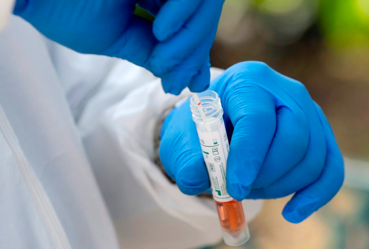 A medical worker places a swab in a vial while testing for COVID-19 a homeless person in Miami, Florida. In the Philippines, particularly in Cebu Island in Central Visayas, the local government units here are gearing up for a targeted mass testing to be implemented soon. | AP photo
