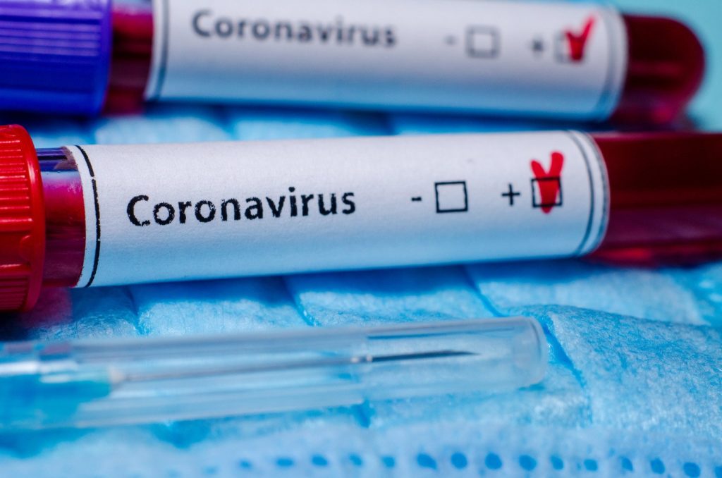 Mandaue City has recorded 15 new coronavirus disease 2019 (COVID-19) cases, 20 recoveries and 3 deaths today, June 21. | AP file photo