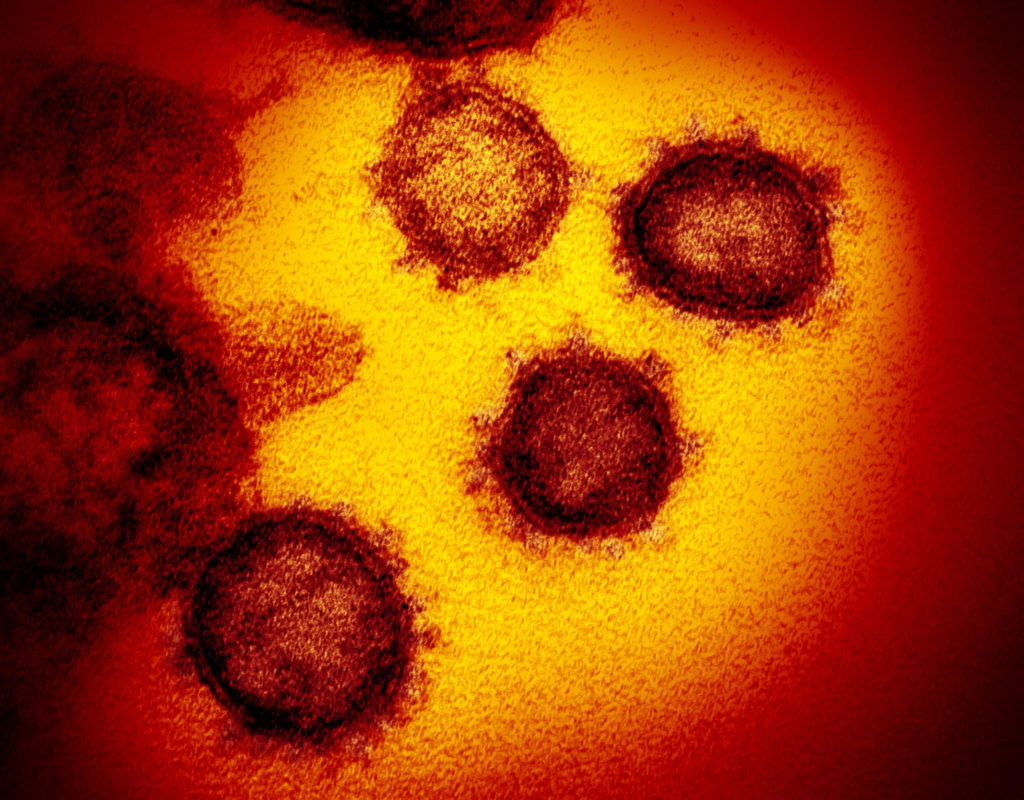 Cebu province has recorded 30 new coronavirus disease 2019 cases on June 4, 2020.