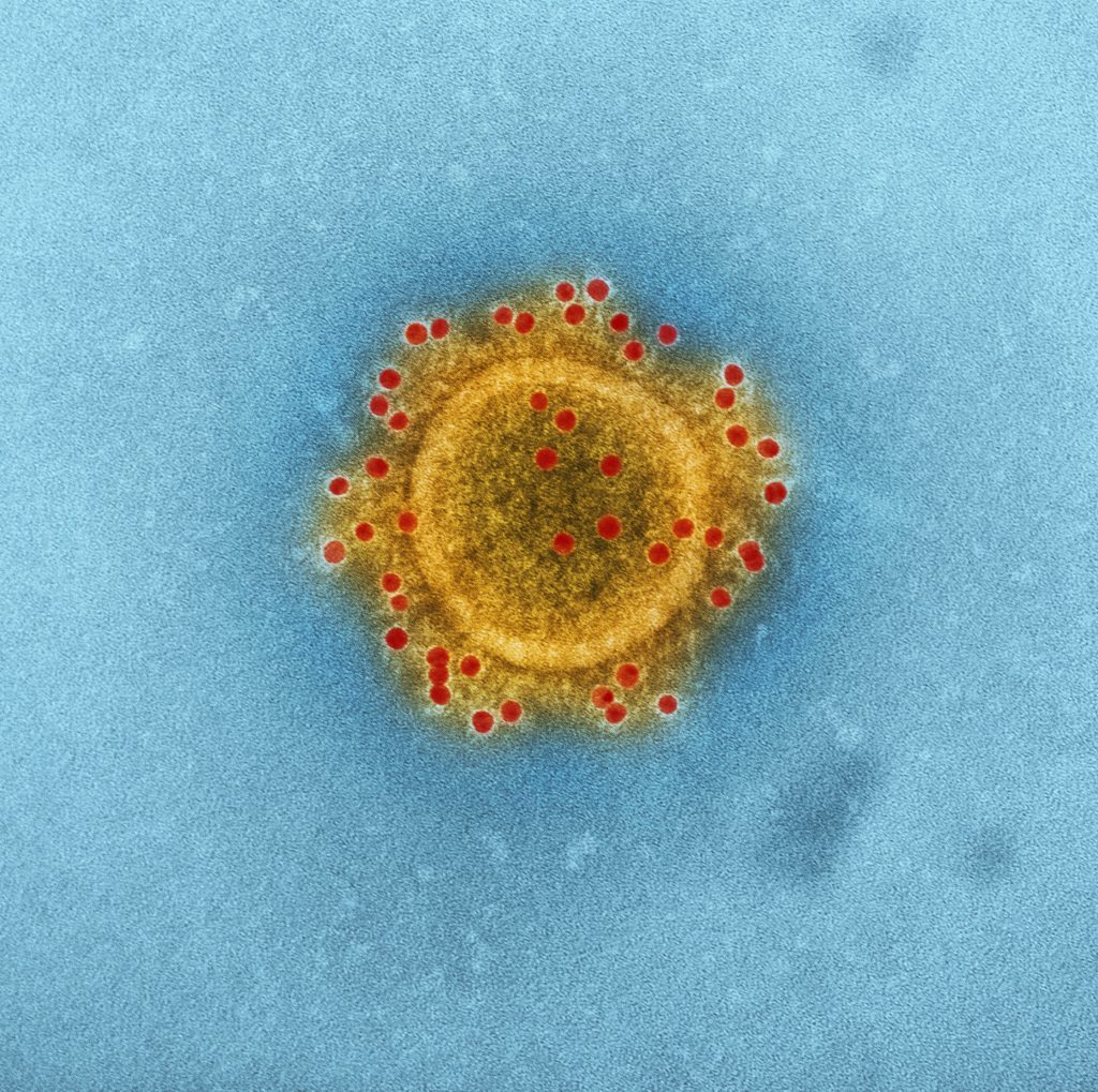 The coronavirus disease 2019 (COVID-19) cases in Cebu City are nearing the 5,000 mark.| stock photo