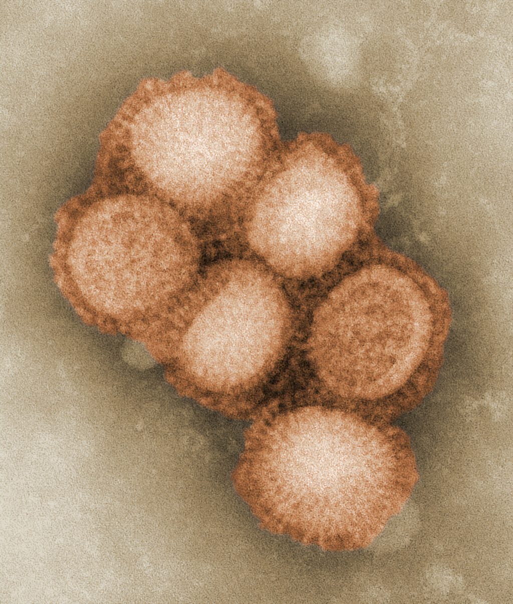 Coronavirus Electron Image | Stock Image