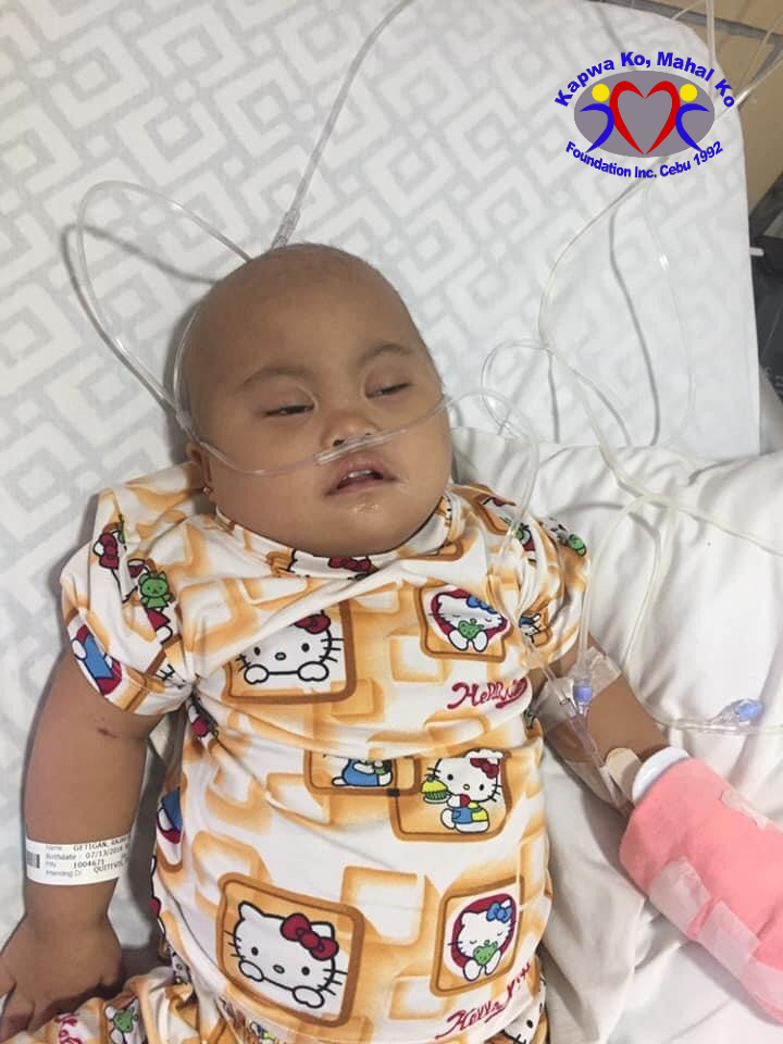 Girl With Leukemia Needs Urgent Assistance Cebu Daily News 9655