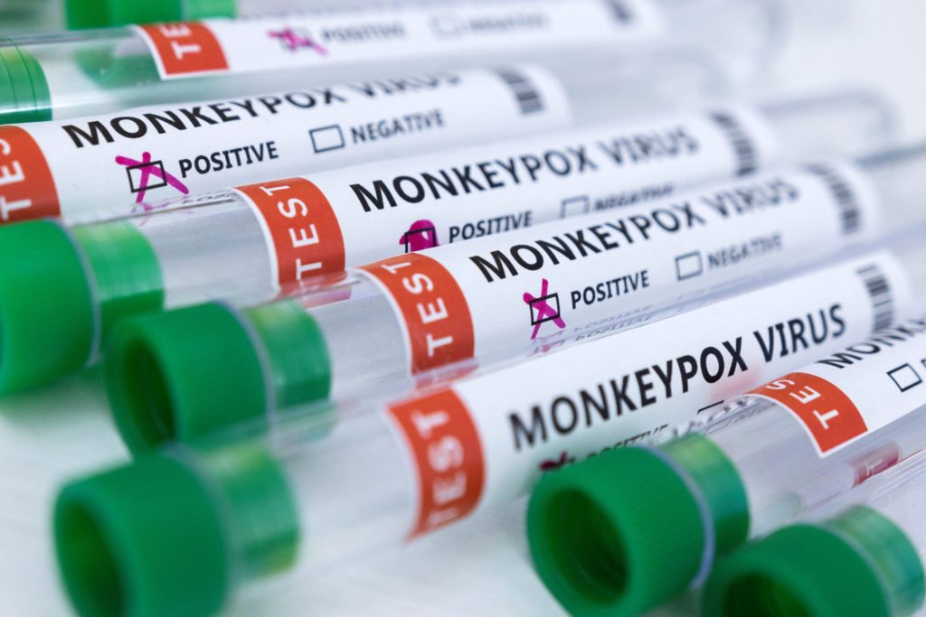 monkeypox cebu