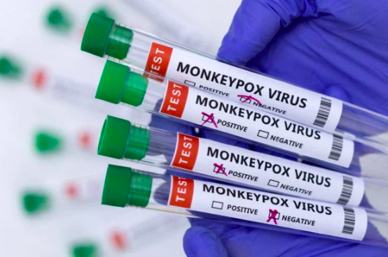 Canada reports 10 new cases of monkeypox, including the first in Ontario. FILE PHOTO: Test tubes labelled “Monkeypox virus positive and negative” are seen in this illustration taken May 23, 2022. REUTERS/Dado Ruvic/Illustration
