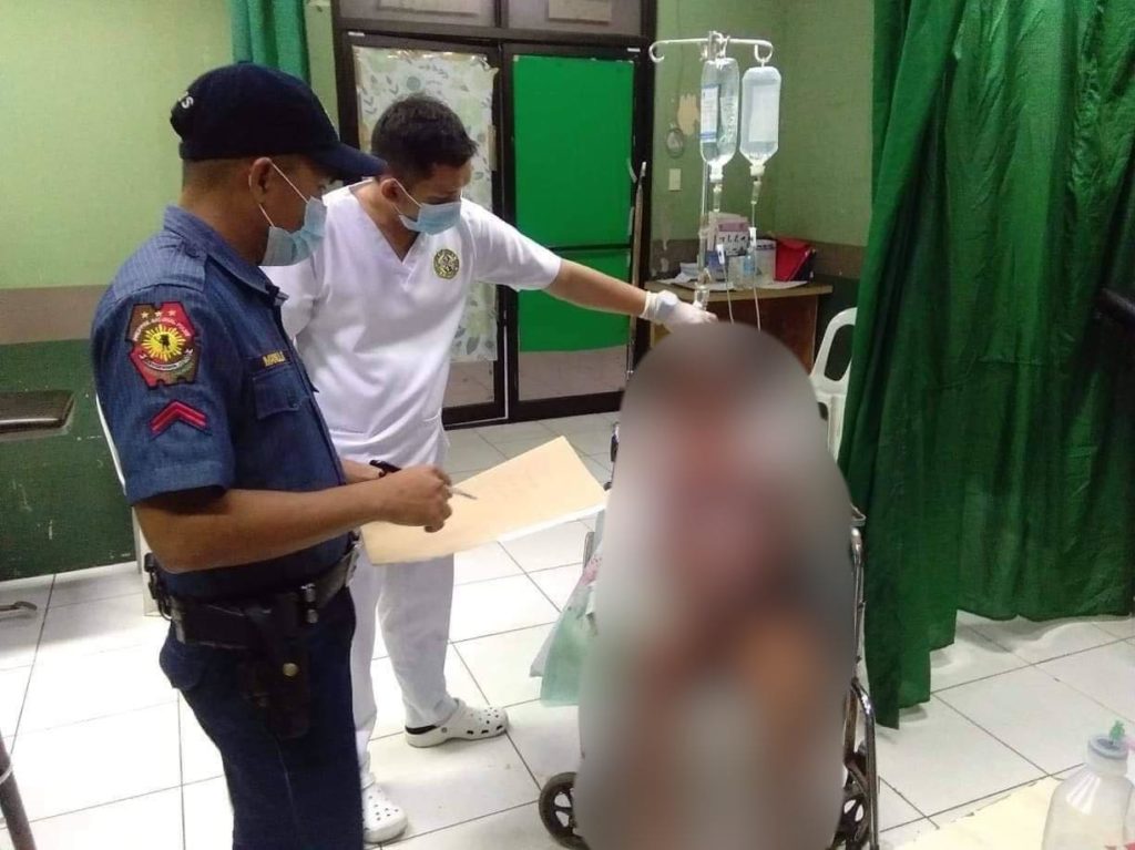 Store owner Suzette Loffel, survived a robbery, where she was shot four times by the robber, who took her P5,000 necklace on Sunday evening, in Barangay Poblacion, Danao City. | Courtesy of Danao City Police Station