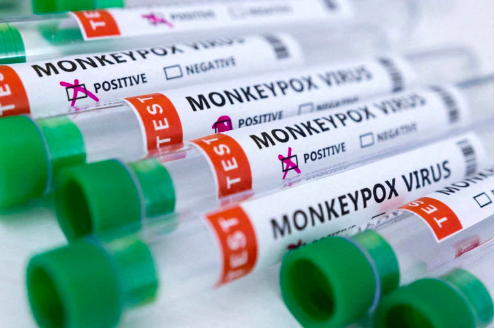 Test tubes labeled “Monkeypox virus positive and negative” are seen in this illustration taken May 23, 2022. (REUTERS FILE PHOTO)
