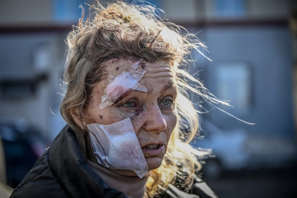 IN PHOTOS: War in Ukraine, a year after