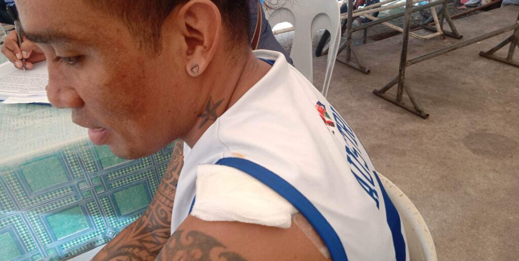 Ex-PBA player Poligrates injured in Duljo shooting