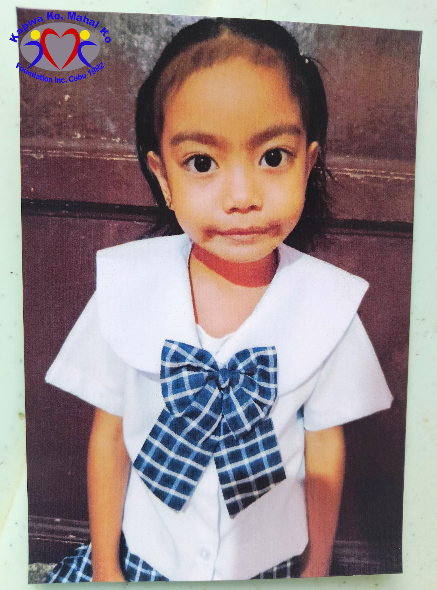 Girl With Heart Defect Urgently Needs Help For Surgery Cebu Daily News 3082