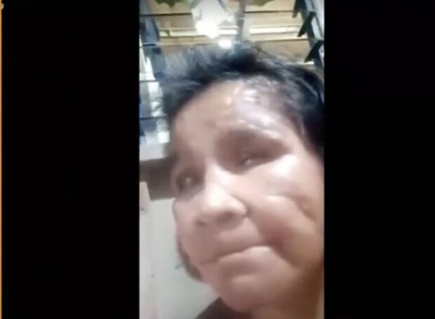 Maltreated maid says employer ordered butcher to hang her in a meat hook . Elvie Vergara, a household help who was allegedly severely abused by her employers in Occidental Mindoro since 2020. (Photo courtesy of Senator Jinggoy Estrada’s official Facebook page)
