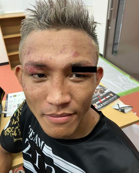 Cataraja questions controversial loss in Japan, demands rematch