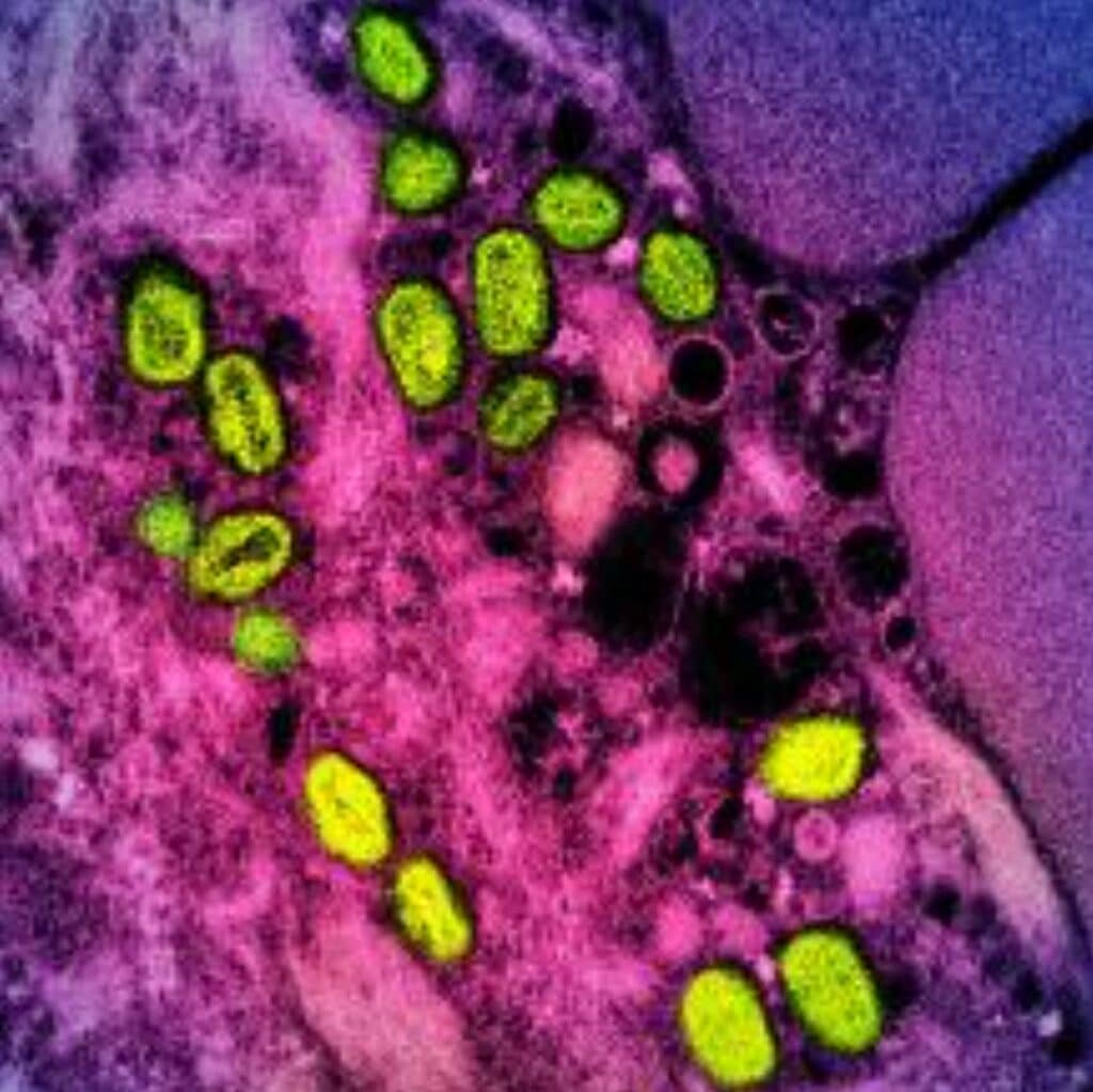 Mpox 'not the new Covid', says WHO. (FILES) This undated file image obtained from the National Institute of Allergy and Infectious Diseases (NIAID) in Bethesda, Maryland, shows a colorized transmission electron micrograph of monkeypox particles (green) found within an infected cell (pink and purple), cultured in the laboratory. | Photo by Handout / National Institute of Allergy and Infectious Diseases / AFP